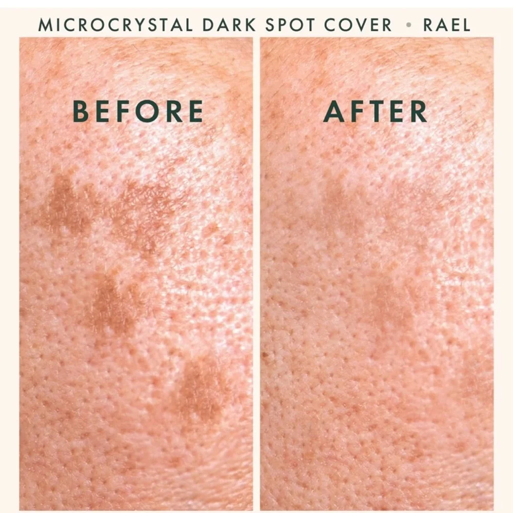 🚨3 for $15🚨 - RAEL BEAUTY - 2x Circa Dark Spot Corrector - Picture 4 of 8